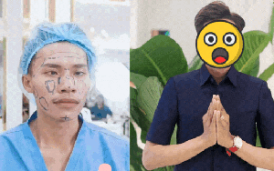 Diện mạo mới của chàng trai hot nhất Nam vương Campuchia sau khi “dao kéo” toàn bộ gương mặt ở Việt Nam