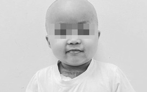 Bé Bắp qua đời sau thời gian "chiến đấu" với bệnh ung thư máu: Dấu hiệu rất dễ nhầm lẫn, điều cần biết để kịp thời phát hiện