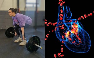 Cô gái đang tập gym bỗng nghe tiếng "sủi bọt" trong cơ thể, bác sĩ chẩn đoán "chỉ còn 24 giờ để sống"