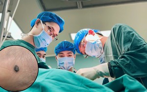 Bàng hoàng nhận tin mắc ung thư sau khi có 1 dấu hiệu ở chân