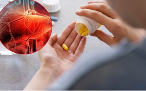 Dùng thuốc kiểu này, 'phá gan' chẳng khác gì uống 1 lít rượu mỗi ngày