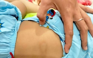 Bình Thuận: Đình chỉ cơ sở giữ trẻ sau vụ bé gái hơn 2 tuổi bị chấn thương "vùng kín"