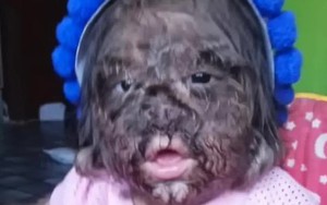 Vì sao bé gái "người sói" đầy lông lá này được gọi là "đứa trẻ đến từ thiên đường"?