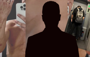 Vụ việc cực sốc: Nam diễn viên công khai hình ảnh bị chuốc thuốc và xâm hại tình dục tới mức suy thận