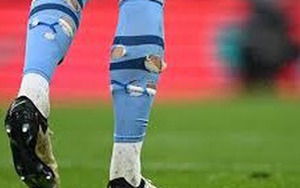 Vì sao các cầu thủ siêu giàu vẫn thích đi tất rách lỗ chỗ như chuột gặm?