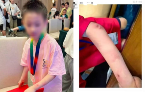 Vụ việc gây rúng động: Thần đồng cờ vây 9 tuổi nghi nhảy lầu tự tử, cộng đồng mạng bàng hoàng