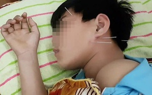 Bé 5 tuổi bị liệt nửa mặt đột ngột: Cảnh báo cha mẹ về căn bệnh trẻ có thể gặp do nằm quạt, điều hòa trong mùa hè