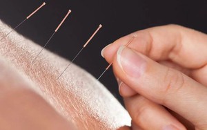 Người đàn ông 47 tuổi phải cắt một bên chân sau khi đi châm cứu