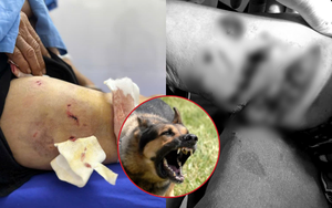 Kinh hoàng cụ bà 77 tuổi ở Yên Bái bị đàn chó lao vào tấn công, chi chít vết thương trên cơ thể