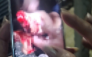 Nhóm côn đồ hung hãn vào phòng trọ chém đứt lìa tay người khác