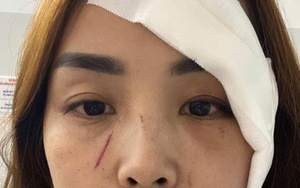 Một phụ nữ ở Nha Trang tố cáo "bị người không quen biết rạch mặt"