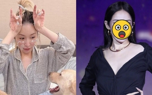 Sốc nặng với "gương mặt rắn" biến dạng của nữ ca sĩ hạng A sau vụ bị chó cắn đến hủy dung