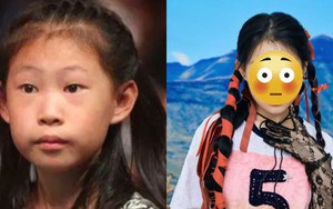 Màn lột xác ngỡ ngàng không tin nổi của "ái nữ" từng bị bạo lực mạng suốt tuổi thơ vì ngoại hình xấu xí