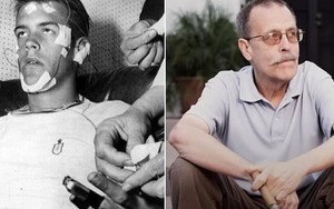 Không ngủ suốt 264 giờ, người đàn ông tiết lộ trải nghiệm kinh hoàng