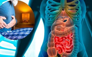 1 dạng ung thư đang tăng mạnh ở người trẻ, nhanh hơn cả ung thư đại trực tràng: Vì sao đáng lo ngại?