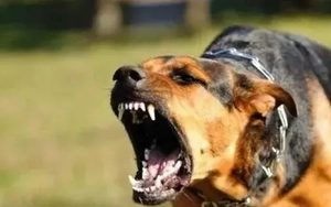 Bé trai 2 tuổi bị chó cắn lộ xương sọ