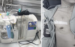 Tràn khí màng phổi do 1 thói quen thường gặp ở người trẻ tập gym