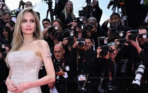 Liệt dây thần kinh số 7 - nỗi ám ảnh của các ngôi sao