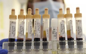 Thế giới phát hiện nhóm máu mới: Sở hữu 1 chi tiết ‘bất thường’, tên gọi cũng rất đặc biệt