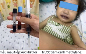 Dùng nước giếng nấu ăn, máu của bé gái chuyển nâu