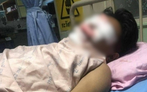 Thiết bị điện phát nổ khiến 3 người bị thương, cảnh sát điều tra phát hiện những dấu hiệu đáng ngờ