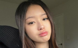 3 nguyên liệu rẻ bèo nhưng ai dùng cũng khen tóc mọc nhanh, da bớt đổ dầu