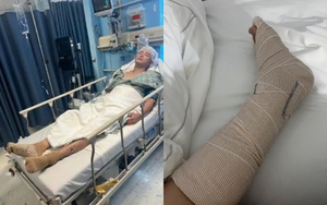 Kinh hoàng nam diễn viên số khổ nhất showbiz bị xe cán nát chân, liên tục lên bàn mổ để giữ mạng 2 năm qua