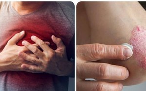 8 dấu hiệu cảnh báo thận không khoẻ