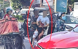 Nam TikToker ở Thái Nguyên bị chém gần đứt lìa bàn tay: Bác sĩ thông báo tin quan trọng