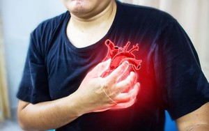 Đau tim 'ập tới' lúc không ngờ nhất, nam bác sĩ kêu gọi tất cả mọi người: 'Đừng mắc sai lầm giống tôi'