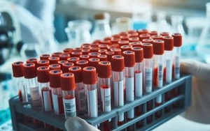 Hà Nội ghi nhận ca viêm não Nhật Bản đầu tiên trong năm, là trẻ 4 tháng tuổi