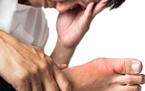 22 tuổi đã mắc gút, gan nhiễm mỡ, rối loạn mỡ máu: Nguyên nhân là ăn 1 thứ quá nhiều, làm 1 việc quá ít