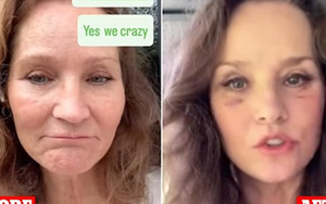 Bà ngoại trông “trẻ ra 20 tuổi” chia sẻ 2 điều hối tiếc lớn nhất sau khi căng da mặt