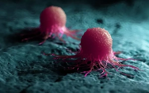 Vaccine Trung Quốc - Singapore ức chế tế bào ung thư gốc, ngăn tái phát và di căn