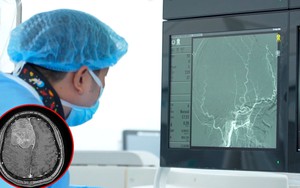 Đi tầm soát đột quỵ, người phụ nữ "sốc" khi nhìn vào ảnh chụp MRI