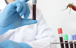 Có nên đi xét nghiệm Chikungunya?