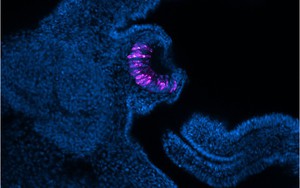 Loài vật có thể "mọc lại" cả nhãn cầu: Phát hiện mới mở kỳ vọng cho y học tái tạo của con người