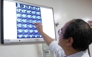 Tưởng chỉ tăng huyết áp, ai ngờ bị u tuyến thượng thận khổng lồ