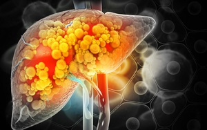 Mỡ trong máu và gan tăng vọt nếu lạm dụng loại đồ uống này: Nhiều người 'vô tư' uống giải khát mỗi ngày