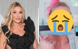 Nữ diễn viên mặt bị "ăn mòn" từng mảng, biến dạng nghiêm trọng vì lí do gì?