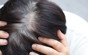 6 thói quen xấu khiến tóc bạc nhanh chóng: Cái cuối cùng nam giới rất hay mắc