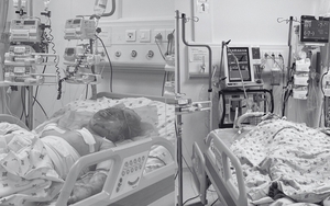 Hai chị em nguy kịch do cha ruột phóng hỏa đốt phòng trọ