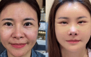 Diễn viên Kim Oanh lên tiếng sau khi gây tranh cãi vì phẫu thuật thẩm mỹ cả gương mặt
