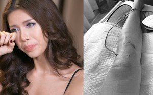 Siêu mẫu Minh Tú sốc vì bị đứt dây chằng chéo trước, rách sụn, dập xương