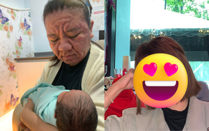 Xót xa gương mặt biến dạng sau khi mang thai của người mẹ trẻ, nhìn lại nhan sắc xinh đẹp trước đó càng không dám tin