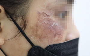 Mỹ phẩm online chưa thôi gây họa