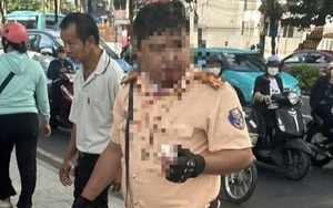 Phân định pháp lý vụ một Trung tá CSGT bị thanh niên người Nga tấn công