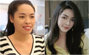 10 năm sau ca phẫu thuật "thay đầu" thành công nhất Việt Nam: Nữ chính được trao thân phận khác nhưng có 1 điều gây tiếc nuối