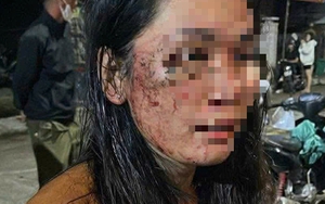 Nữ shipper tố bị khách hàng hành hung