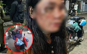 Nữ shipper tố bị vợ chồng chủ nhà đánh nhập viện: Nguồn cơn từ bộ quần áo 900.000 đồng